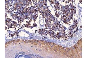 Immunohistochemistry (IHC) image for anti-Keratin 18 (KRT18) (C-Term) antibody (ABIN870573) (Cytokeratin 18 anticorps  (C-Term))