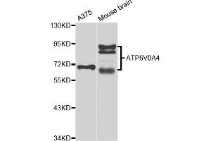 Western blot analysis of extracts of various cell lines, using ATP6V0A4 antibody (ABIN5974639) at 1/1000 dilution. (ATP6V0A4 anticorps)