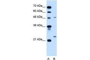 Western Blotting (WB) image for anti-Sphingomyelin phosphodiesterase 2, Neutral Membrane (Neutral Sphingomyelinase) (SMPD2) antibody (ABIN2462850) (SMPD2 anticorps)