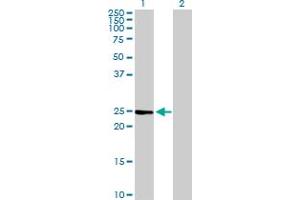 Western Blot analysis of IL6 expression in transfected 293T cell line by IL6 MaxPab polyclonal antibody. (IL-6 anticorps  (AA 1-212))