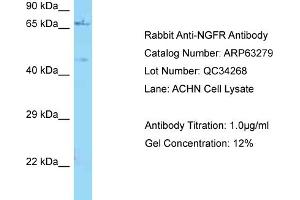 Western Blotting (WB) image for anti-Nerve Growth Factor Receptor (NGFR) (C-Term) antibody (ABIN971261) (NGFR anticorps  (C-Term))