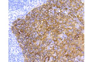 Paraformaldehyde-fixed, paraffin embedded human tonsil, Antigen retrieval by boiling in sodium citrate buffer (pH6) for 15min, Block endogenous peroxidase by 3% hydrogen peroxide for 30 minutes, Blocking buffer at 37°C for 20min, Antibody incubation with Cytokeratin 5 (2H5) Monoclonal Antibody  at 1:50 overnight at 4°C, followed by a conjugated secondary and DAB staining. (Cytokeratin 5 anticorps)