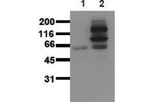 Western Blotting (WB) image for anti-Catenin (Cadherin-Associated Protein), beta 1, 88kDa (CTNNB1) (pTyr654) antibody (ABIN126742) (CTNNB1 anticorps  (pTyr654))