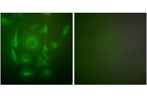 Immunofluorescence analysis of HepG2 cells, using Keratin 7 Antibody. (Cytokeratin 7 anticorps  (AA 420-469))