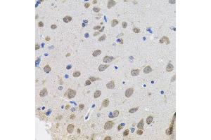 Immunohistochemistry of paraffin-embedded rat brain using VEPH1 antibody (ABIN5974616) (40x lens). (VEPH1 anticorps)