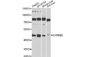 Western blot analysis of extracts of various cell lines, using CHRNB2 Antibody (ABIN6003540) at 1/1000 dilution. (CHRNB2 anticorps)