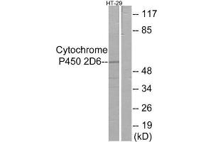 Western Blotting (WB) image for anti-Cytochrome P450, Family 2, Subfamily D, Polypeptide 6 (CYP2D6) (Internal Region) antibody (ABIN1850357) (CYP2D6 anticorps  (Internal Region))