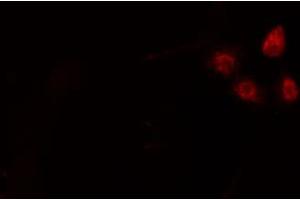 ABIN6274204 staining HepG2 cells by IF/ICC. (NFYA anticorps  (C-Term))