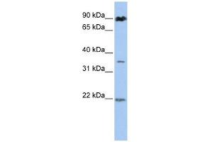 C13ORF7 antibody used at 1 ug/ml to detect target protein. (RNF219 anticorps  (N-Term))