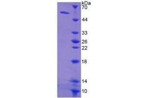 SDS-PAGE of Protein Standard from the Kit (Highly purified E. (TK1 Kit ELISA)