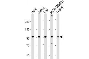 All lanes : Anti-NLRP3 Antibody (N-term) at 1:1000-1:2000 dilution Lane 1: Hela whole cell lysate Lane 2: Jurkat whole cell lysate Lane 3: Raji whole cell lysate Lane 4: MDA-MB-231 whole cell lysate Lane 5: THP-1 whole cell lysate Lysates/proteins at 20 μg per lane. (NLRP3 anticorps  (N-Term))