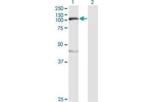 Western Blot analysis of MYLK expression in transfected 293T cell line by MYLK monoclonal antibody (M01), clone 1D1. (MYLK anticorps  (AA 1710-1809))