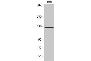 Western Blotting (WB) image for anti-PTK2 Protein tyrosine Kinase 2 (PTK2) (Thr444) antibody (ABIN3180043) (FAK anticorps  (Thr444))