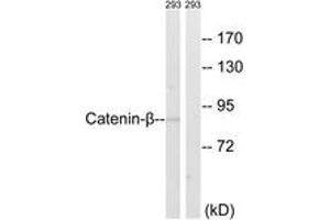 Western blot analysis of extracts from 293 cells, using Catenin-beta (Ab-489) Antibody. (beta Catenin anticorps  (AA 455-504))
