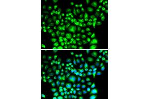 Immunofluorescence analysis of U2OS cells using BCAP31 antibody (ABIN5974244). (BCAP31 anticorps)