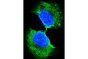Confocal immunofluorescence analysis of PC-3 cells using GSTP1 antibody (green). (GSTP1 anticorps)