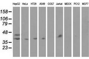 Western blot analysis of extracts (35 µg) from 9 different cell lines by using anti-HP monoclonal antibody. (Haptoglobin anticorps)