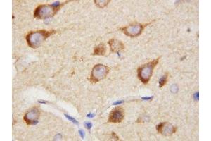 IHC-P: PPID antibody testing of rat brain tissue (PPID anticorps  (AA 351-370))