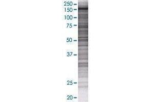 RAB6IP1 transfected lysate. (RAB6IP1 293T Cell Transient Overexpression Lysate(Denatured))