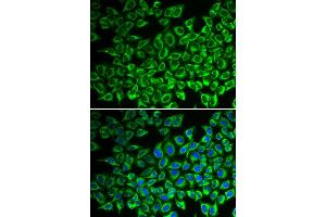 Immunofluorescence (IF) image for anti-Interleukin 12 Receptor beta 1 (IL12RB1) antibody (ABIN1980210) (IL12RB1 anticorps)