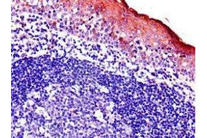 Immunohistochemistry of paraffin-embedded human tonsil tissue using ABIN7145203 at dilution of 1:100 (BIRC3 anticorps  (AA 76-245))