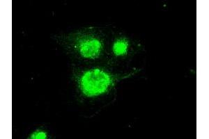 Image no. 1 for anti-Periostin (POSTN) (AA 1-230) antibody (ABIN1490615) (Periostin anticorps  (AA 1-230))