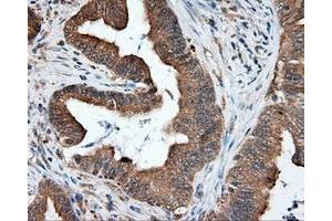Immunohistochemical staining of paraffin-embedded liver tissue using anti-RC219453 mouse monoclonal antibody. (NPR3 anticorps)