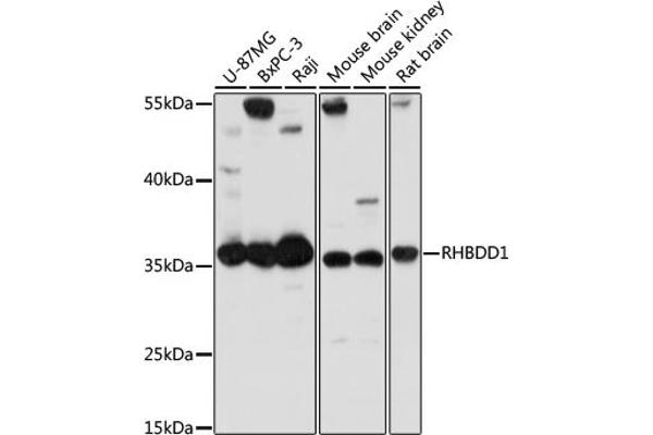 RHBDD1 anticorps  (AA 206-315)