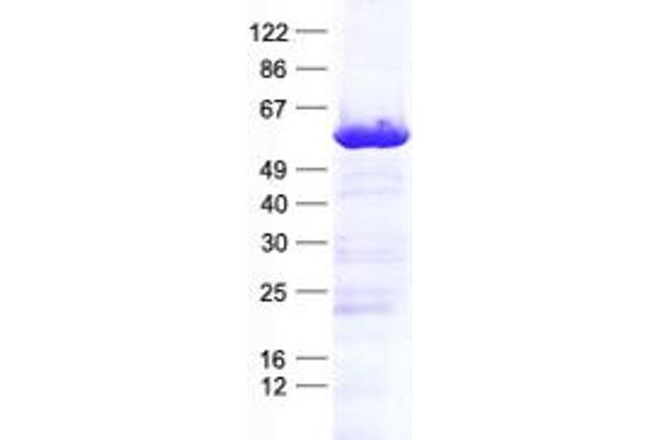 KIAA1456 Protein (KIAA1456) (His tag)