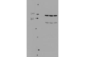 Western blot analysis of Mouse kidney tissue lysates showing detection of ENaC protein using Rabbit Anti-ENaC Polyclonal Antibody . (SCNN1A anticorps  (AA 46-68) (Atto 488))