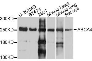 Western blot analysis of extracts of various cell lines, using ABCA4 antibody (ABIN5997165) at 1/1000 dilution. (ABCA4 anticorps)