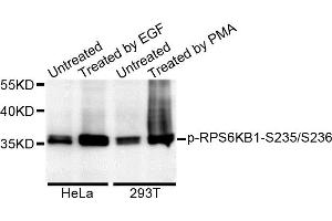 Western blot analysis of extracts of various cell lines, using Phospho-RPS6KB1-S235/236 antibody. (RPS6KB1 anticorps)