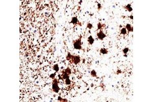 IHC staining of human brain with PGP9. (UCHL1 anticorps)