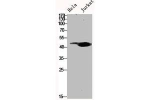 Western Blot analysis of Hela Jurkat cells using MYLIP Polyclonal Antibody (MYLIP anticorps  (Internal Region))