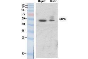 Western Blotting (WB) image for anti-Glucagon-Like Peptide 1 Receptor (GLP1R) (Internal Region) antibody (ABIN3175279) (GLP1R anticorps  (Internal Region))