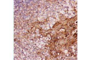 Anti-Annexin A1 Picoband antibody,  IHC(P): Human Tonsil Tissue (Annexin a1 anticorps  (AA 2-346))