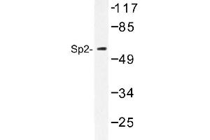 Image no. 1 for anti-Sp2 Transcription Factor (Sp2) antibody (ABIN272208) (Sp2 anticorps)