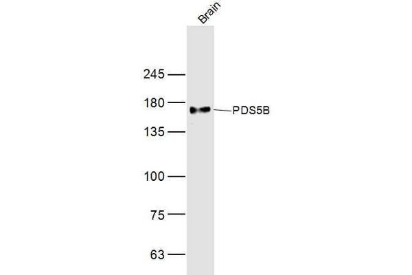 PDS5B anticorps  (AA 1051-1150)