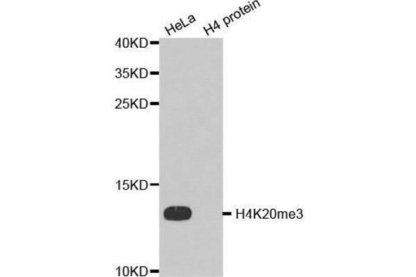 Histone H4 anticorps  (3meLys20)