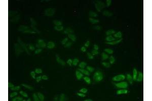 IHC-P analysis of Human HeLa cells, with FITC staining. (BLVRB anticorps  (AA 2-206))