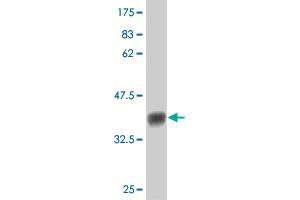 Western Blot detection against Immunogen (36. (FLT4 anticorps  (AA 34-133))