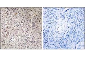 Immunohistochemistry (IHC) image for anti-Glucosaminyl (N-Acetyl) Transferase Family Member 7 (GCNT7) (AA 311-360) antibody (ABIN2890158) (GCNT7 anticorps  (AA 311-360))