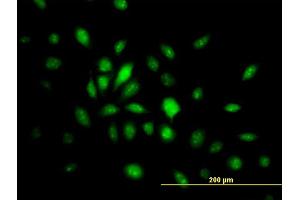 Immunofluorescence of monoclonal antibody to HMG20B on HeLa cell. (HMG20B anticorps  (AA 1-109))