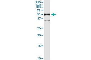 Immunoprecipitation of ALDH3A1 transfected lysate using rabbit polyclonal anti-ALDH3A1 and Protein A Magnetic Bead (ALDH3A1 (Humain) IP-WB Antibody Pair)