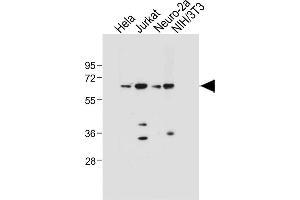 All lanes : Anti-SD4 Antibody  at 1:1000 dilution Lane 1: Hela whole cell lysate Lane 2: Jurkat whole cell lysate Lane 3: Neuro-2a whole cell lysate Lane 4: NIH/3T3 whole cell lysate Lysates/proteins at 20 μg per lane. (SMAD4 anticorps  (AA 255-284))