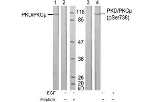 Image no. 1 for anti-Protein Kinase D1 (PRKD1) (Ser738) antibody (ABIN197313) (PKC mu anticorps  (Ser738))