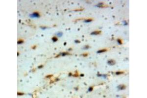Used in DAB staining on fromalin fixed paraffin-embedded Heart tissue (ADIPOQ anticorps  (AA 108-244))