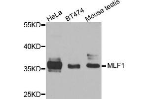Western blot analysis of extracts of various cell lines, using MLF1 antibody (ABIN5974950) at 1/1000 dilution. (MLF1 anticorps)