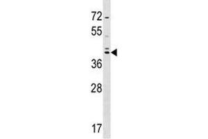 SOX7 antibody western blot analysis in HepG2 lysate. (SOX7 anticorps  (AA 310-339))