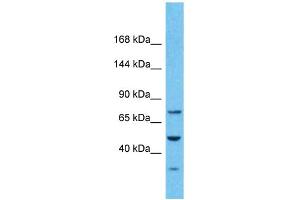 Host:  Rabbit  Target Name:  PKD2  Sample Type:  Stomach Tumor lysates  Antibody Dilution:  1. (PKD2 anticorps  (N-Term))